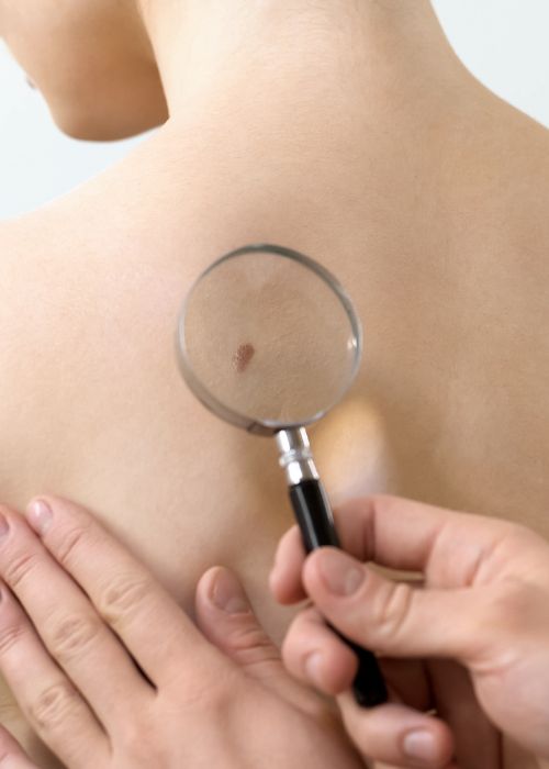 Skin Cancer Clinic Lismore